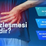 bel düzleşmesi nedir