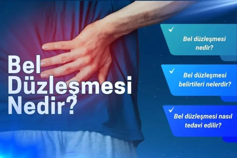 Bel Düzleşmesi Nedir? Bel Düzleşmesi Neden Olur?