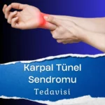 Karpal Tünel Sendromu Tedavisi
