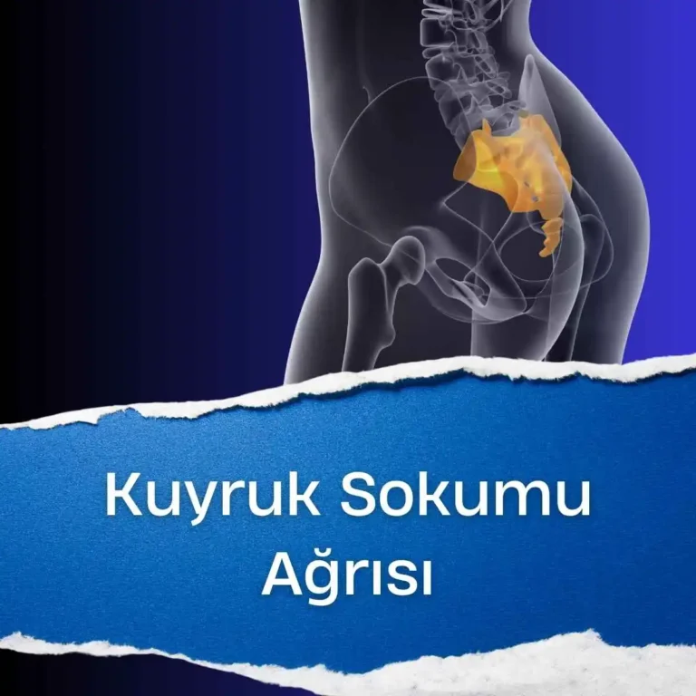 Kuyruk Sokumu Ağrısı (Koksidinia) Nedir? Nasıl Tedavi Edilir?