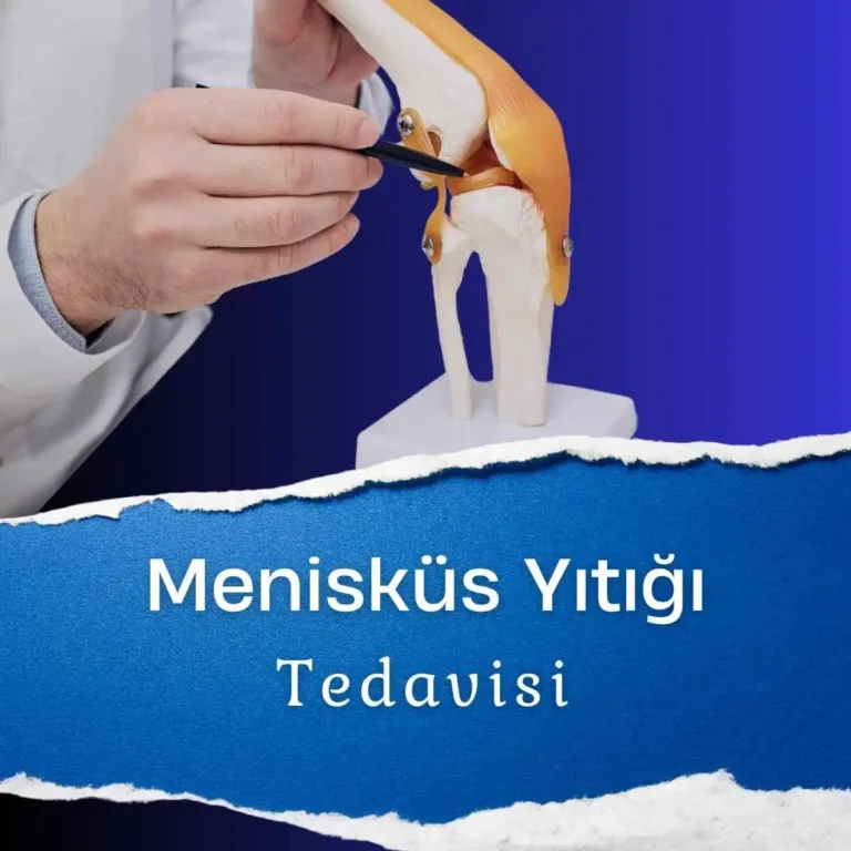 Menisküs Yırtığı Tedavisi Nasıl Yapılır?