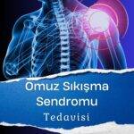 Omuz Sıkışma Sendromu Tedavisi