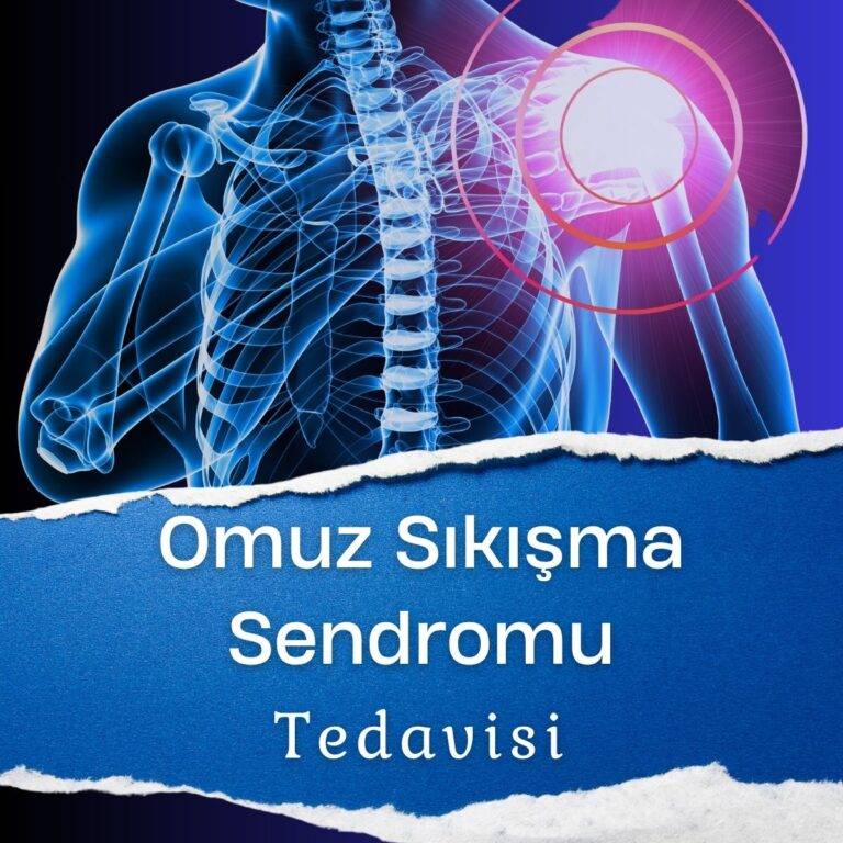 Omuz Sıkışma Sendromu Tedavisi