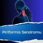 Piriformis Sendromu