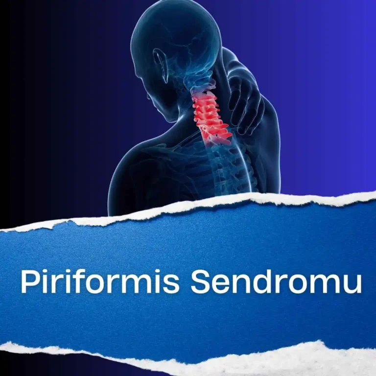 Piriformis Sendromu Nedir?