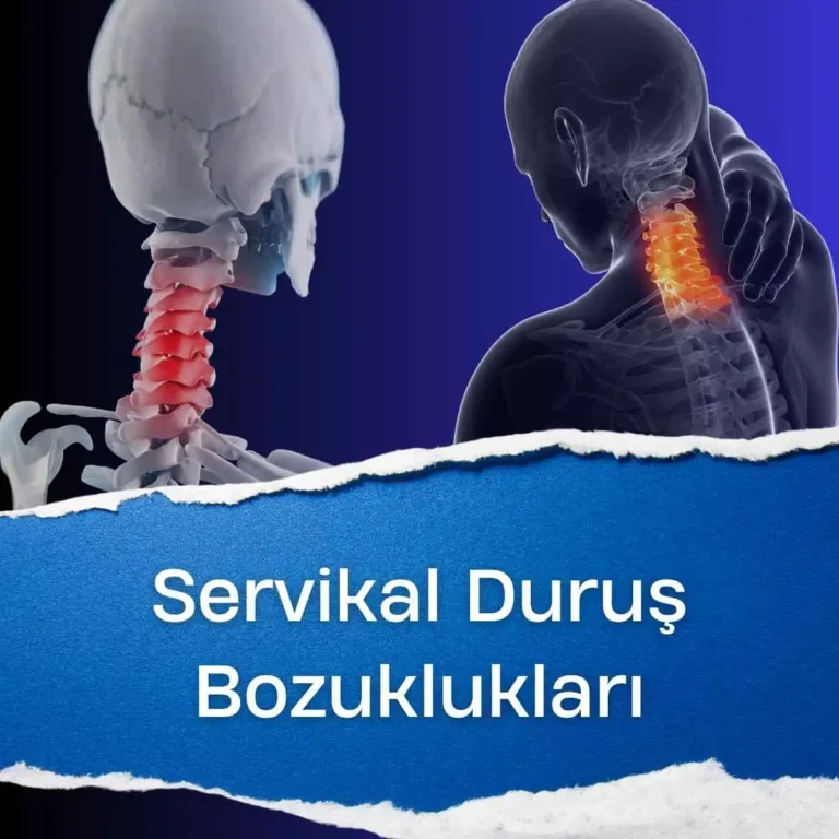 Servikal Duruş Bozuklukları Nelerdir?