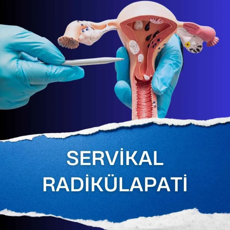 Servikal Radikülapati Nedir?