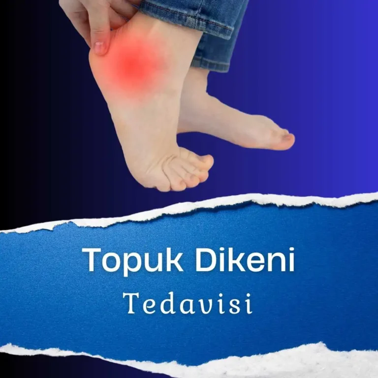 Topuk Dikeni Tedavisi