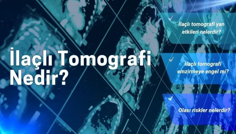 İlaçlı Tomografi Nedir? İlaçlı Tomografi Nasıl Yapılır?