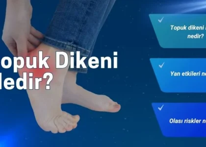 topuk dikeni nedir