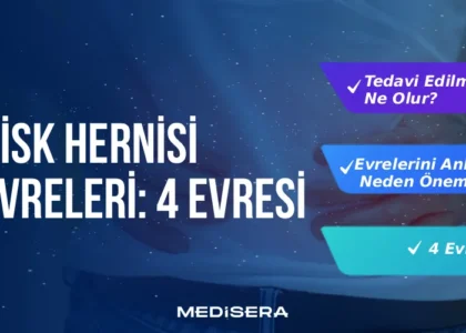 disk-hernisi-evreleri-4-evresi-