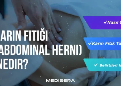 karin-fitigi-abdominal-herni-nedir-881x501-