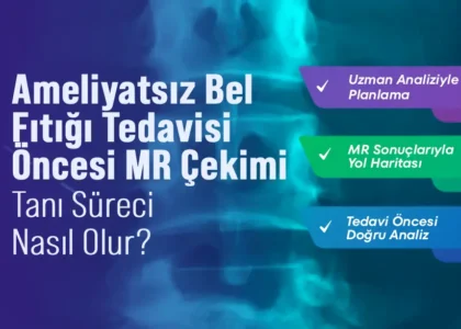 Ameliyatsız Bel Fıtığı Tedavisi Öncesi MR Çekimi