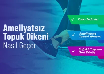Ameliyatsız Topuk Dikeni Nasıl Geçer