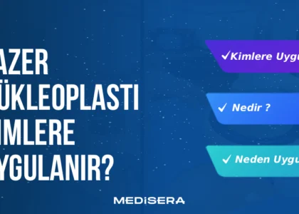 Lazer Nükleoplasti Kimlere Uygulanır?