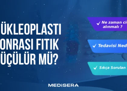 nukleoplasti-sonrasi-fitik-kuculur-mu
