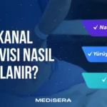 Dar Kanal Tedavisi Nasıl Planlanır?