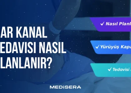 Dar Kanal Tedavisi Nasıl Planlanır?
