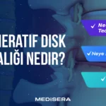 Dejeneratif Disk Hastalığı Nedir?