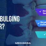 Disk Bulging Nedir?